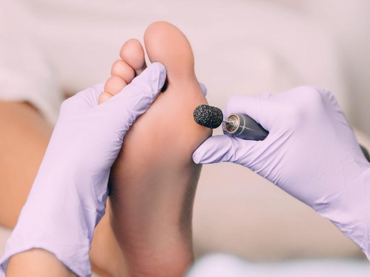 Pedicure podologiczny