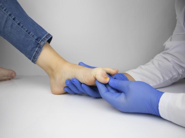 Badanie paznokcia stopy